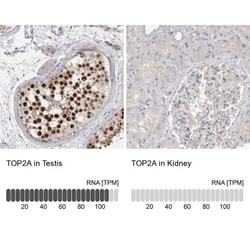 TOP2A Antibody, Novus Biologicals 0.1mL; Unlabeled:Antibodies, Polyclonal